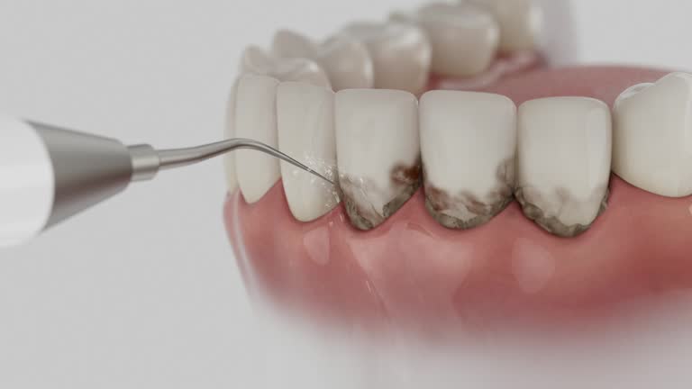 Trusted Root Canal Treatment service in Lexington, VA - Dentist Open Now